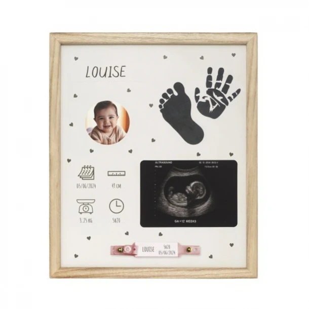 Birth Frame Petit Artichaut PA2601
